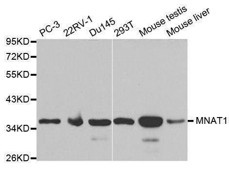 Anti-MNAT1 Antibody