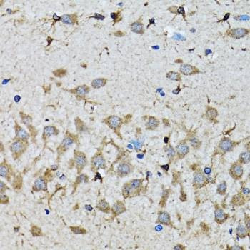 Anti-SMAD5 Antibody