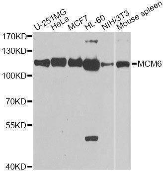 Anti-MCM6 Antibody