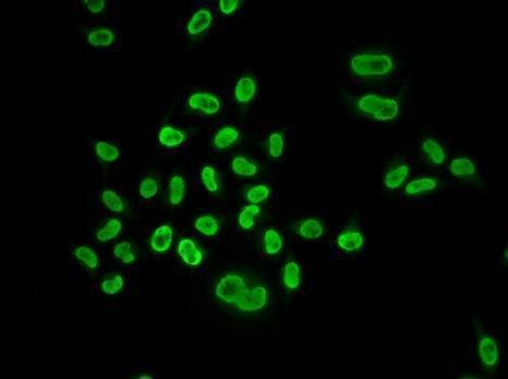 Anti-MCM6 Antibody