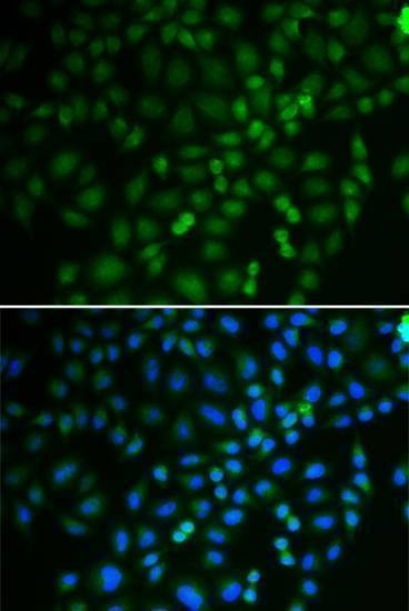 Anti-TRIM21 Antibody