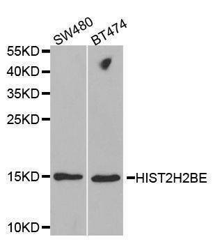 Anti-HIST2H2BE Antibody