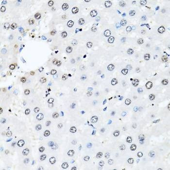 Anti-HIST2H2BE Antibody