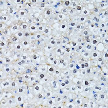 Anti-HIST2H2BE Antibody