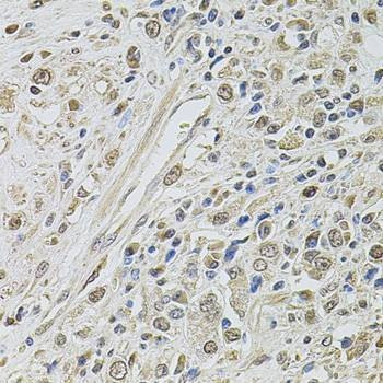 Anti-SMARCC2 Antibody