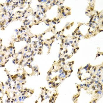 Anti-NR1I3 Antibody
