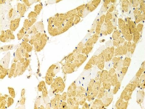 Anti-PLCB1 Antibody
