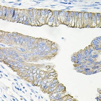 Anti-ACVR2A Antibody