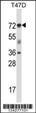 Anti-FOXK2 (N-term) Antibody