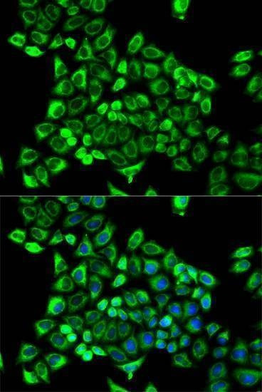 Anti-CDA Antibody