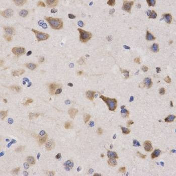 Anti-KPNA4 Antibody