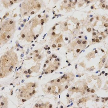 Anti-KPNA4 Antibody