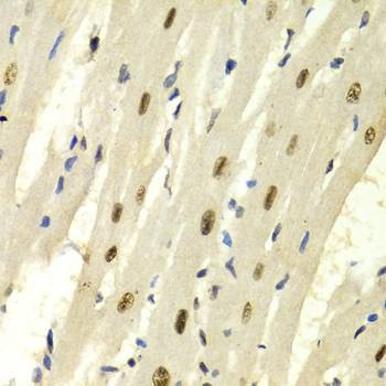 Anti-KPNA4 Antibody