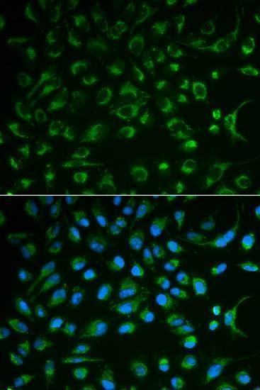 Anti-NT5E Antibody