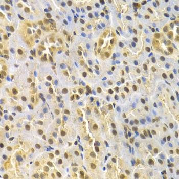 Anti-RUNX1 Antibody