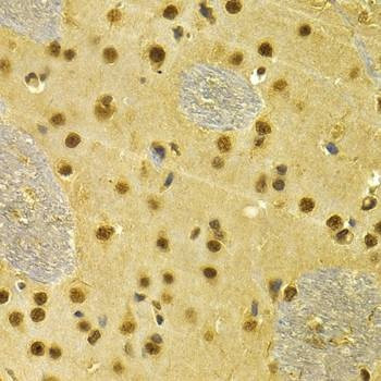 Anti-RUNX1 Antibody