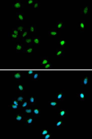 Anti-RUNX1 Antibody