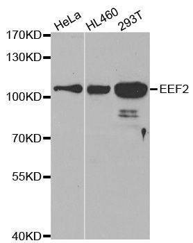 Anti-EEF2 Antibody
