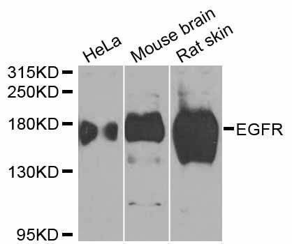 Anti-EGFR Antibody