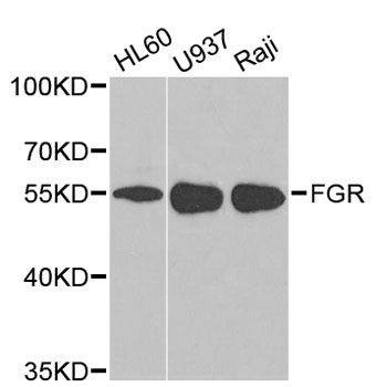 Anti-FGR Antibody