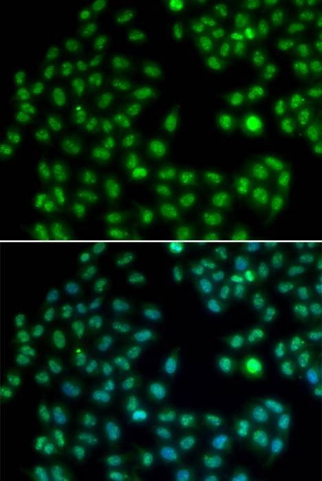 Anti-MKI67 Antibody