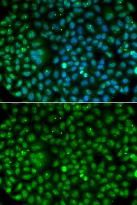 Anti-MKI67 Antibody