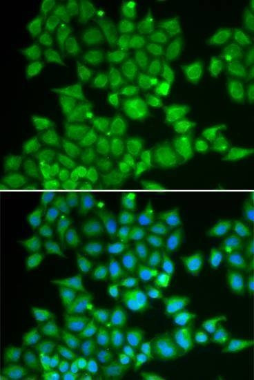 Anti-PDE1B Antibody