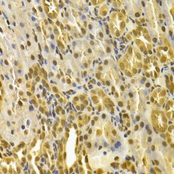 Anti-PIN1 Antibody