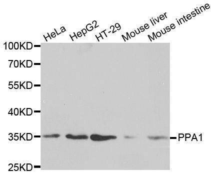 Anti-PPA1 Antibody