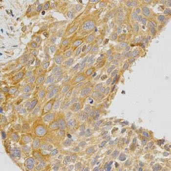 Anti-PRKCE Antibody