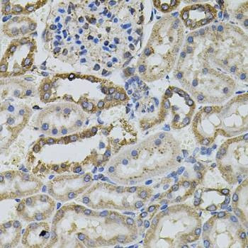Anti-PTPRC Antibody