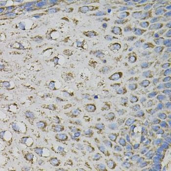 Anti-PTPRC Antibody