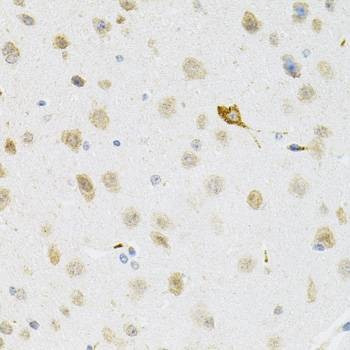 Anti-SYK Antibody