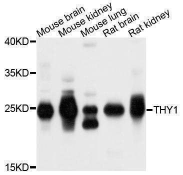 Anti-THY1 Antibody
