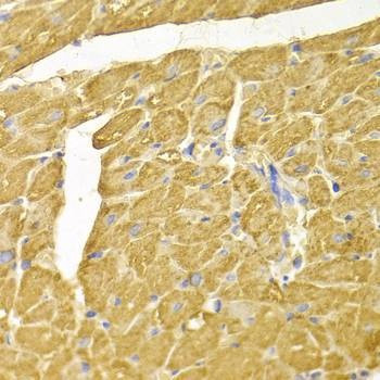 Anti-NDRG1 Antibody