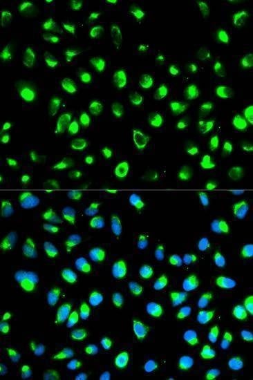 Anti-NDRG1 Antibody