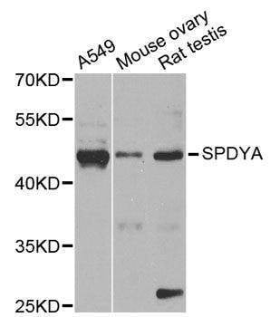 Anti-SPDYA Antibody