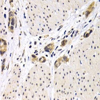 Anti-ATF2 Antibody
