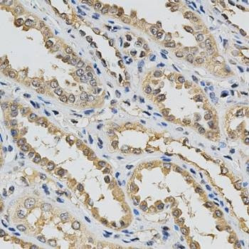 Anti-EIF4E Antibody