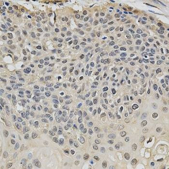 Anti-EIF4E Antibody