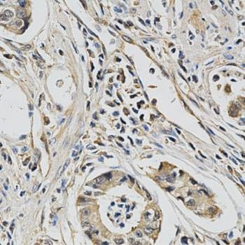Anti-EIF4E Antibody