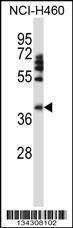 Anti-FOXD1 (N-term) Antibody