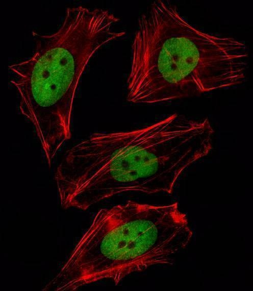 Anti-FOXD1 (N-term) Antibody