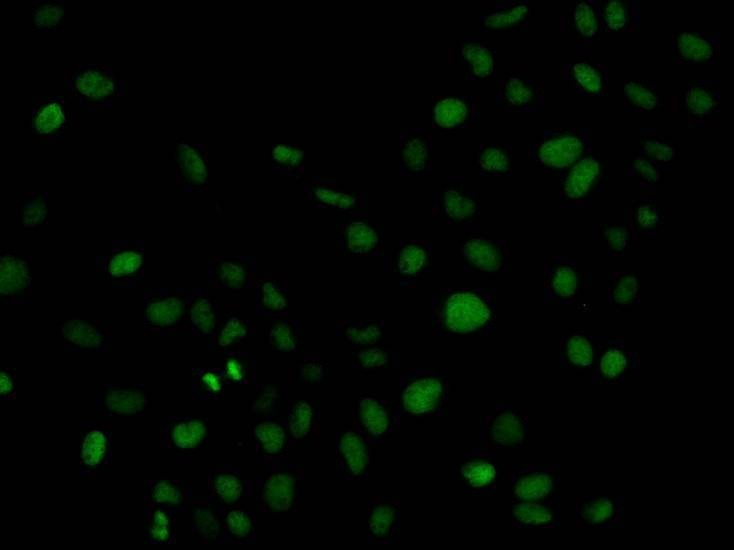 Anti-PLCG2 Antibody