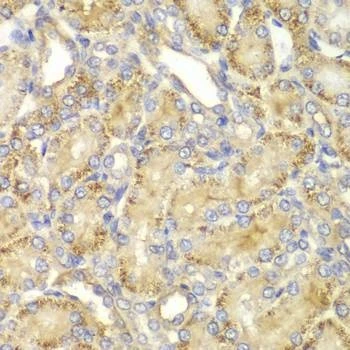 Anti-PPP2R2A Antibody