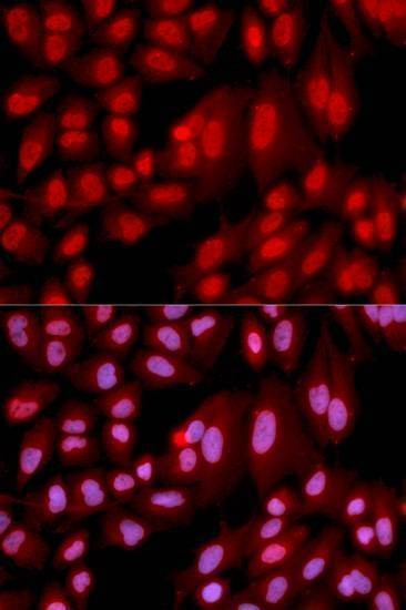 Anti-PPP2R2A Antibody