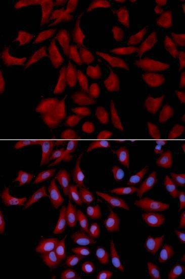 Anti-UBE2I Antibody