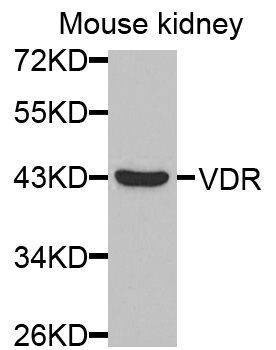 Anti-VDR Antibody