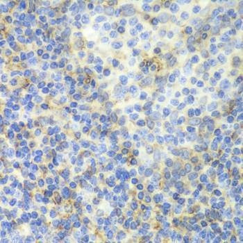 Anti-ZAP70 Antibody