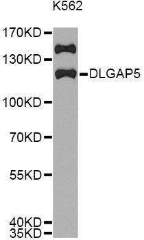 Anti-DLGAP5 Antibody